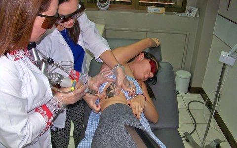Eliminación de Tatuajes
